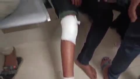 टीकमगढ़: देहात थाने के पास पिकअप वाहन की टक्कर से ई-रिक्शा चालक हुआ घायल, जिला अस्पताल में भर्ती