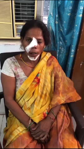 मुंशी पुलिया चौराहे पर तेज रफ्तार कार ने महिला को मारी टक्कर, महिला हुई घायल