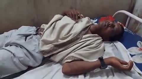 शहपुरा: कनेरी गांव में ज़मीन विवाद में छोटे भाई ने बड़े भाई को पीटा, घायल का शहपुरा अस्पताल में इलाज जारी