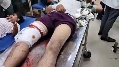 हाथरस: मथुरा-बरेली हाईवे के रामपुर कट पर कार की टक्कर से बाइक सवार दो लोग हुए घायल, एंबुलेंस से लाया गया अस्पताल