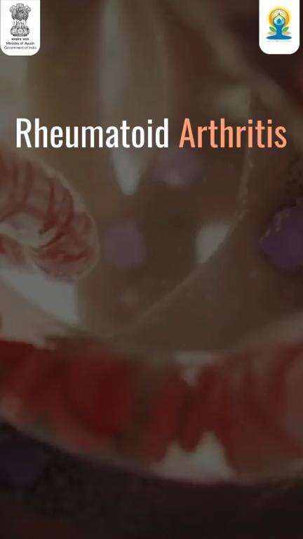 Yoga as an adjunct therapy in Rheumatoid Arthritis
#IDY2024 #YogaforSelfandSociety #CCRH #MoA #InternationalYogaDay2024