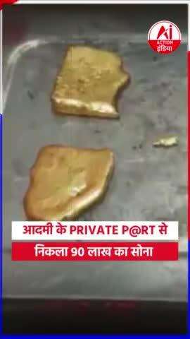 Aadmi ke private part se nikla 90 Lakh ka sona #ajab_gajab #video #viral