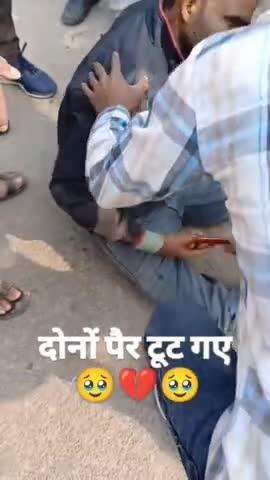 बाइक धीरे चलाए इस भाई के दोनों पैर टूट गया 😭😭#viral #viral #nagra