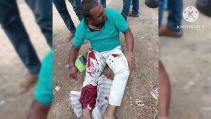 తొర్రూర్: మాటేడు వద్ద ఘోర రోడ్డు ప్రమాదం, లారీని ఓవర్ టేక్ చేసే క్రమంలో కారును ఢీకొన్న ద్విచక్ర వాహనం, వ్యక్తికి తీవ్ర గాయాలు