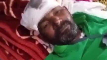 नारनौद: नारनौंद में अज्ञात गाड़ी चालक ने दो लोगों को टक्कर मारी, एक हिसार के निजी अस्पताल और दूसरा अग्रोहा के मेडिकल कॉलेज में भर्ती