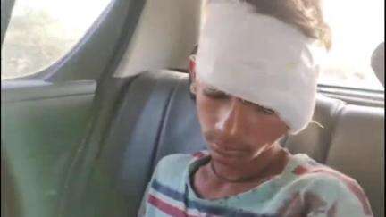 पूंगल: बीएलडी में अज्ञात जानवर ने चार जनों पर किया हमला, महिला और बालिका को जोधपुर रेफर किया गया