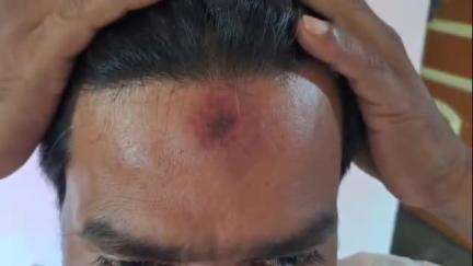 পূর্বস্থলী ২: বুঠে করে মেরেছে, পুরুষাঙ্গে মেরছে, এটা কি মুঘলরাজ চলছে? DI গিয়ে পুলিশের হাতে আক্রান্ত হয়ে পূর্বস্থলীতে বললেন খোকন লাল