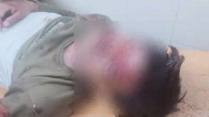 काटोल: बाजारगाव परिसरात उभ्या ट्रकला  दुचाकीची धडक उपचारा दरम्यान युवकाचा मृत्यू