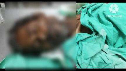 রঘুনাথপুর ১: রঘুনাথপুর সুপার স্পেশালিটি হাসপাতালে চিকিৎসাধীন অবস্থায় অজ্ঞাত পরিচয় ব্যক্তির মৃত্যু, পাঠানো হল ময়নাতদন্তে