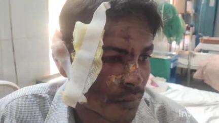 माकड़ी: बालोंड गांव का युवक कांटागांव में बाइक से गिरकर घायल, फरसगांव अस्पताल में भर्ती