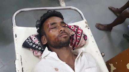 कुटुंबा: अंबा बाजार स्थित चौराहा पर अज्ञात वाहन की चपेट में आने से बाइक सवार युवक घायल, सामान की खरीदारी करने गया था