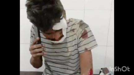 त्योंदा: बासौदा मार्ग पर आवारा पशु को बचाने के प्रयास में अनियंत्रित होकर फिसली बाइक, युवक हुआ घायल