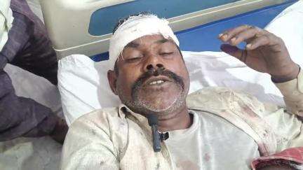 फरीदपुर: भुता थाना क्षेत्र के ग्राम सरकडा में दबंगों ने दो युवकों को जमकर पीटा, अस्पताल में कराया भर्ती