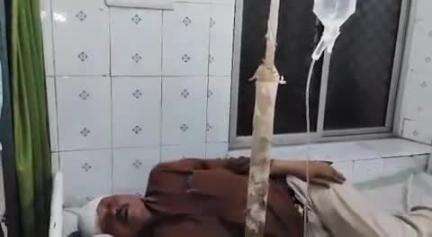 नौगांव: नौगांव थाना क्षेत्र में 65 वर्षीय वृद्ध पर पत्थर से हमला, गांव के ही युवक ने किया हमला