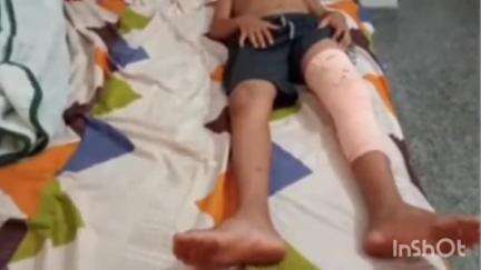 കൊയിലാണ്ടി: പേരാമ്പ്രയിൽ മദ്യലഹരിയിൽ അയൽവാസി 12 വയസ്സുകാരനെ മർദ്ദിച്ചു, കേസെടുത്ത് പോലീസ്