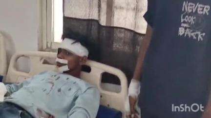 धरमपुरी: उमरखलाय मार्ग पर अचानक सड़क पर आया जंगली सुअरों का झुंड, बाइक सवार दो युवक गिरकर हुए घायल