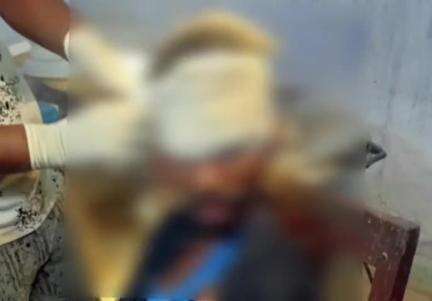 মানবাজার ২: বুরুডি মোড়ে দুটি বাইকের সংঘর্ষে আহত দুই যুবক