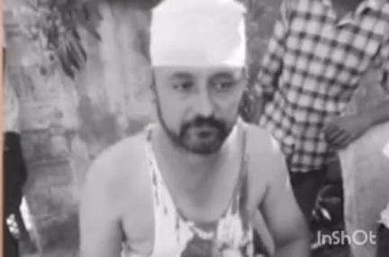 बाली: बाली में नगरपालिका पार्षद पर हमला, देर रात घर में घुसकर धारदार हथियार से किया वार, सिर में आए 8 टांके, मामला दर्ज