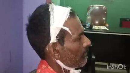 खुसरूपुर: हैबतपुर गांव में बदमाशों ने बाप-बेटे को पीटकर घायल किया