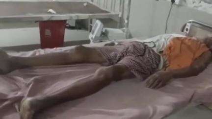 रंका: जंगली मधुमक्खी के हमले से 22 प्लॉट निवासी ग्रामीण घायल, रंका सामुदायिक स्वास्थ्य केंद्र में चल रहा इलाज