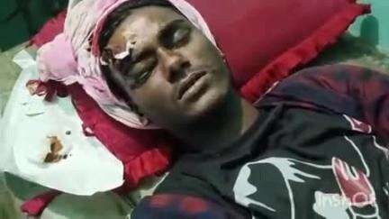 मधेपुर: रहुआ-संग्राम गांव में मुख्य सड़क पर दो बाइकों की टक्कर, तीन सवार घायल
