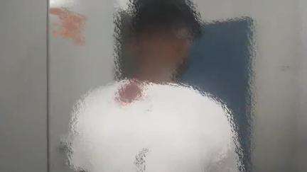 रफीगंज: रफीगंज के भादवा बाजार में सब्जी खरीदकर लौट रहे युवक के साथ हुई मारपीट, घायल को CHC में कराया गया भर्ती
