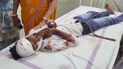 काको: अमथुआ के पास अपाचे बाइक की ट्रक से टक्कर, तीन युवक घायल