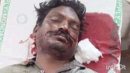 రుద్రవరంలో విద్యుత్ షాక్‌తో కేబుల్ ఆపరేటర్ మృతి