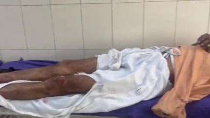 हांसी: हांसी में दो बाइक की टक्कर, पांच लोग घायल, तीन की हालत गंभीर, बीमार साले का हालचाल पूछने जा रहे थे