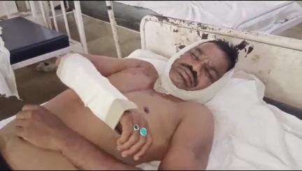 बांसवाड़ा: प्रथ्वीपुरा गांव में चचेरे भाइयों ने पूर्व विवाद को लेकर भाई के सिर पर सरिया मारा, एमजी अस्पताल में उपचार जारी