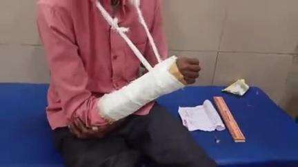 पडरौना: नोनिया पट्टी से पटहेरवा मार्ग पर बाइक और बोलेरो के बीच टक्कर, बाइक सवार गंभीर घायल, अस्पताल में भर्ती