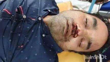 చంద్రగిరి బైపాస్ రోడ్డులో 2 బైకులు ఢీ, ఇద్దరికి తీవ్ర గాయాలు