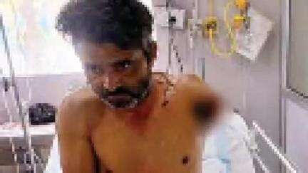 बहल: गांव हरियावास में बिजली की तार की चपेट में आने से युवक झुलसा, हाथ पड़ा काटना