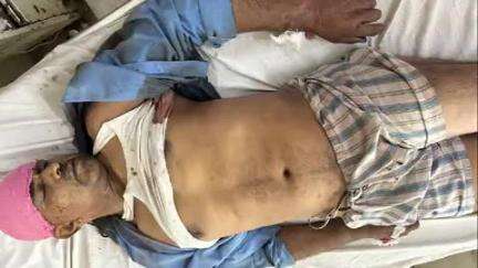 बाह: भाउपुरा के पास ड्यूटी पर जा रहे होमगार्ड को ट्रक ने रौंदा, इलाज के दौरान हुई मौत