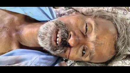 చొప్పదండి: అర్నకొండలో గుర్తుతెలియని వాహనం ఢీకొని చికిత్స పొందుతూ 50 సంవత్సరాల వ్యక్తి మృతి
