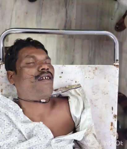 बैकुंठपुर: दुर्घटना में घायल व्यक्ति को उपचार के लिए जिलाअस्पताल बैकुंठपुर लाया गया, पहचान के लिए सोशल मीडिया पर की गई अपील