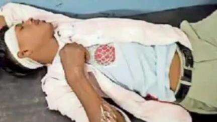 केसली: पटना मेहका रोड पर अनियंत्रित बाइक से गिरकर पिता-पुत्र हुए घायल, अस्पताल में भर्ती
