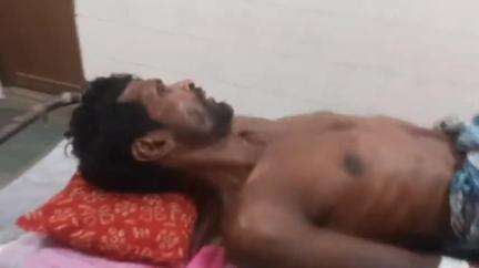 বহরমপুর: মজ্ঝেমপুরে ছাদে খড় পালা দেয়ার সময় পড়ে জখম এক ব্যক্তি, বহরমপুরের MMC&H-লে আনা হয়েছে চিকিৎসার জন্য