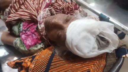 বহরমপুর: সিলগ্রামে ঘুমন্ত অবস্থায় চৌকির উপর থেকে পড়ে মাথা ফেটে আহত এক মহিলা, চিকিৎসার জন্য আনা হয়েছে বহরমপুর MMC হাসপাতালে