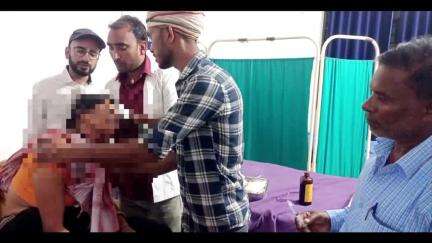 हुसैनगंज: रफीपुर गांव के काजी टोला में पट्टीदारों के बीच झड़प, एक महिला घायल, अस्पताल में भर्ती