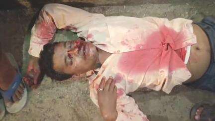 बिश्रामपुर: बी मोड़-विश्रामपुर मुख्य पथ पर बरवाडीह में सड़क दुर्घटना, एक युवक घायल, पुलिस ने अस्पताल भेजा
