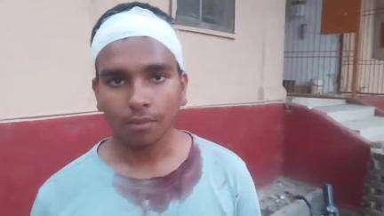 लालगंज: लालगंज पीड़ापुर सहवाग गांव में मारपीट, दो व्यक्ति गंभीर रूप से घायल