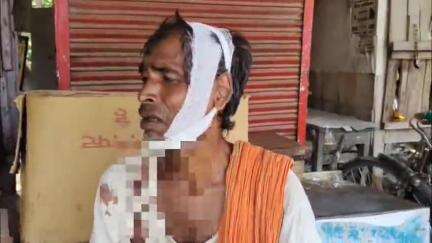 नवाबगंज: जैदपुर के उसरी में बिगड़े सरकारी नल को बनवाने को लेकर पोते ने दादा को पीटा, पीड़ित ने थाने में की शिकायत