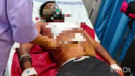 जगदलपुर: दलपत सागर चौक में आदतन अपराधी ने दो युवकों पर चाकू से हमला किया, दोनों गंभीर रूप से घायल, मेडिकल कॉलेज में उपचार जारी