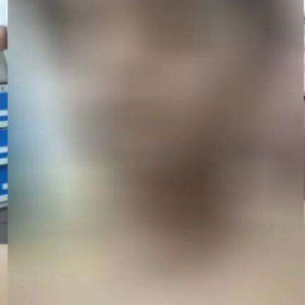 चांडिल: इस्लामनगर बाबा गुंडी के पास आवारा कुत्ते के हमले से बालक घायल