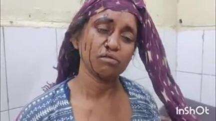 कोल: जलालपुर में बच्चों के विवाद के चलते बंजारा समाज के लोगों में हुई मारपीट, घटना में 3 घायल, एक महिला अस्पताल पहुंची