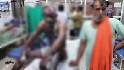 हाथरस: गांव कोकना खुर्द में एक शख्स केमिकल में लगी आग से जलकर गंभीर रूप से घायल, परिजन एम्बुलेंस से लेकर आए जिला अस्पताल