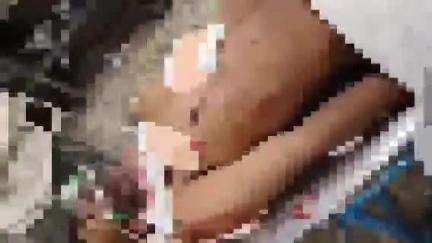 जबलपुर: शास्त्री नगर में युवक पर चाकू से हमला, शराब पीने के लिए ₹500 की मांग