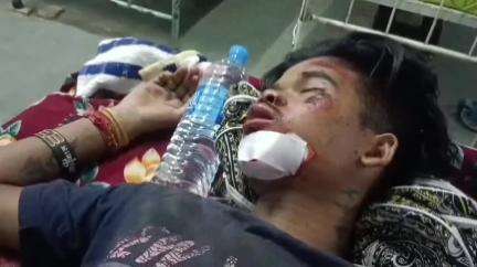 তুফানগঞ্জ ২: রসিক বিল এলাকায় মোটর সাইকেল দূর্ঘটনায় আহত একজন, ভর্তি হাসপাতালে