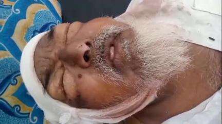 राजगढ़: राजगढ़ के करेड़ी में डंपर की टक्कर से घायल बुजुर्ग की भोपाल में मौत